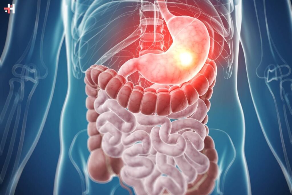 Gastrointestinal Specialists Raise Awareness of Stomach Cancer Symptoms and Prevention | Healthcare 360 Magazine