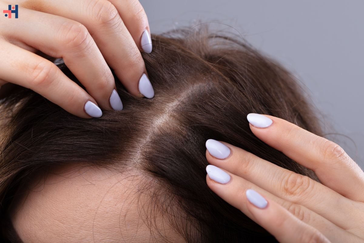 Understanding Thinning Hair: Causes, Treatment, and Management | Healthcare 360 Magazine