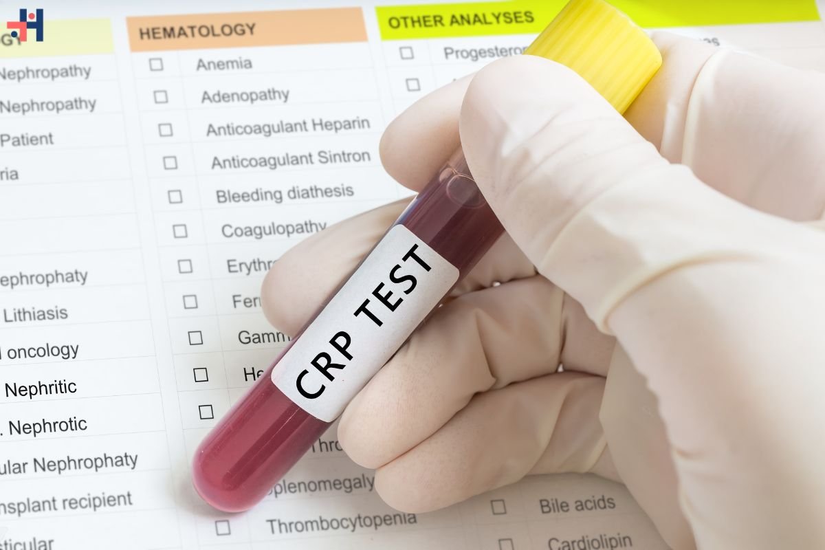 Understanding CRP Levels in Blood: A Comprehensive Guide | Healthcare 360 Magazine