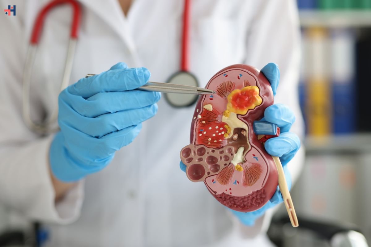 Understanding Chronic Kidney Disease: Causes, Symptoms, and Management