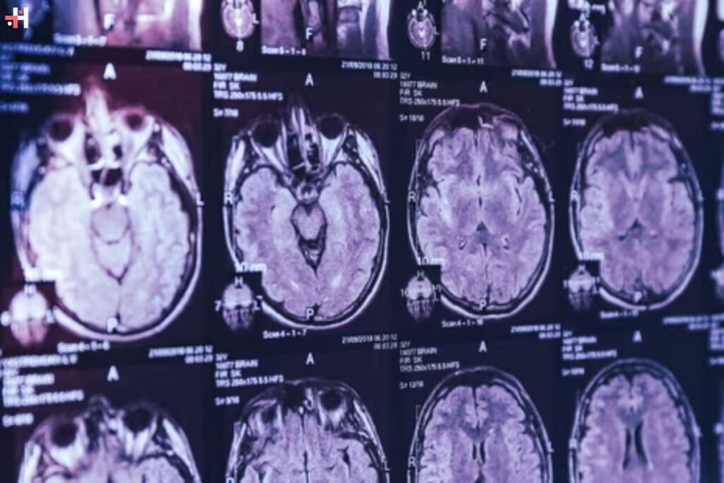 Investigating New Brunswick Mysterious Brain Illness | Healthcare 360 Magazine