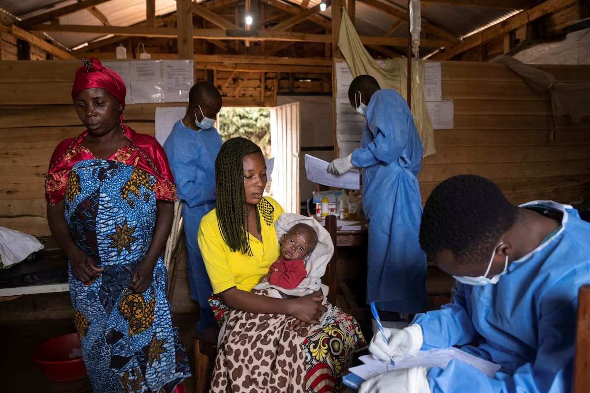 Mpox Patients in Eastern DR Congo Struggle with Medicine and Food Shortages