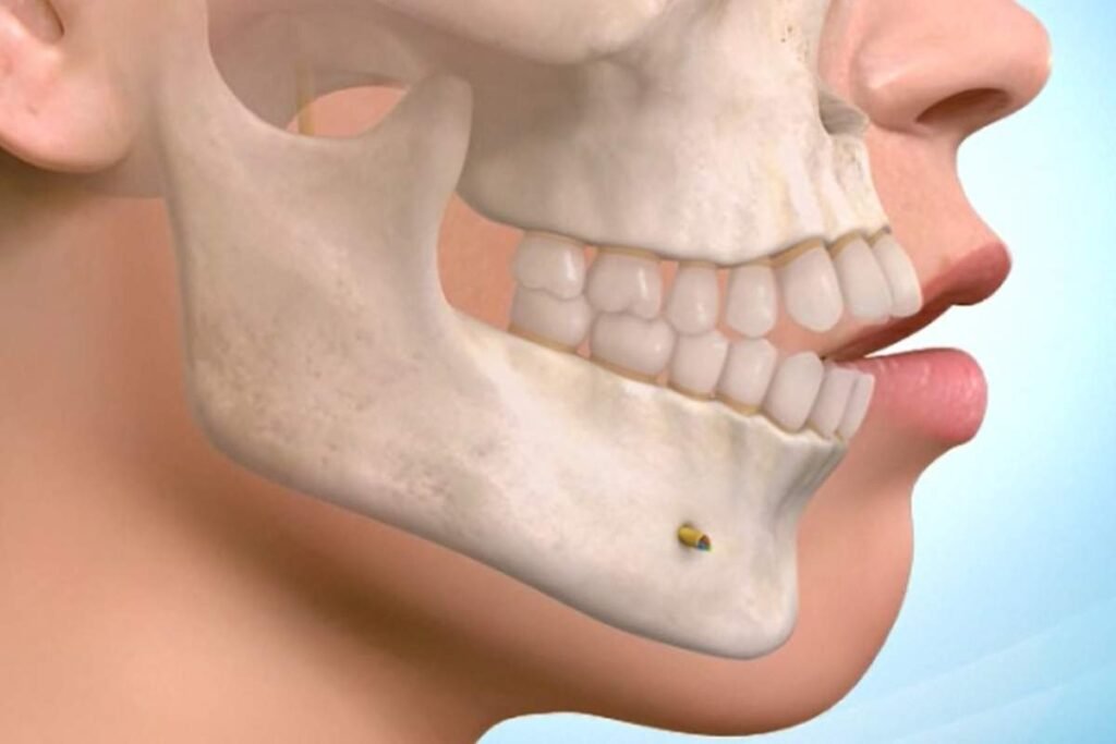 Jaw Surgery Orthognathic: Definition, Side Effects and Benefits | Healthcare 360 Magazine