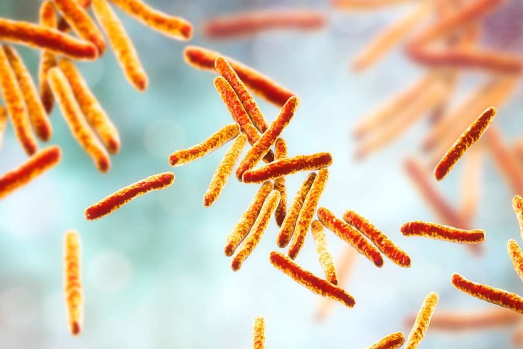 Massive Tuberculosis Outbreak in Kansas Sparks Public Health Concern | Healthcare 360 Magazine