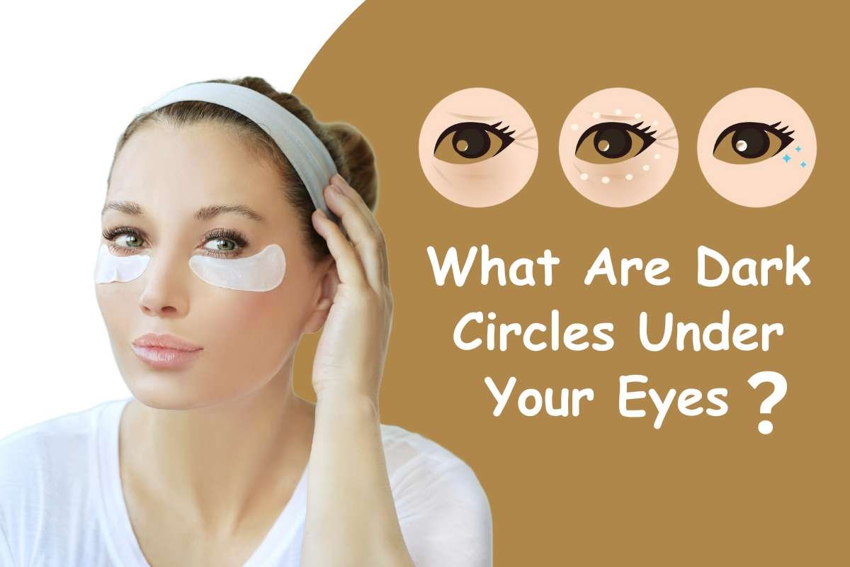 How to Get Rid of Dark Circles Naturally? | Healthcare 360 Magazine