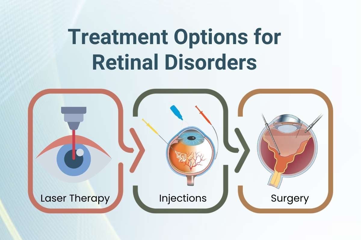 Types of Retinal Disorders: Causes, Symptoms, and Treatments | CyberPro Magazine