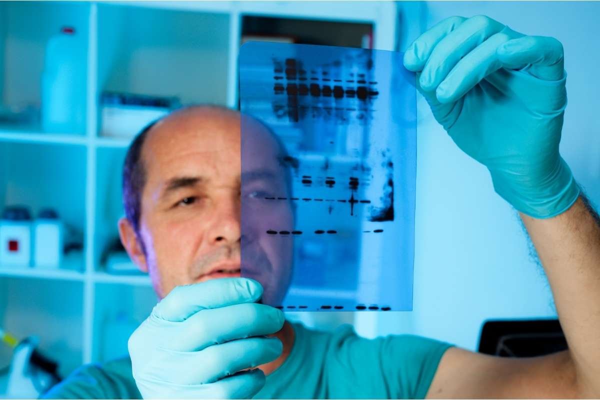 Western Blotting: Hidden Science Behind Cancer Research | Healthcare 360 Magazine