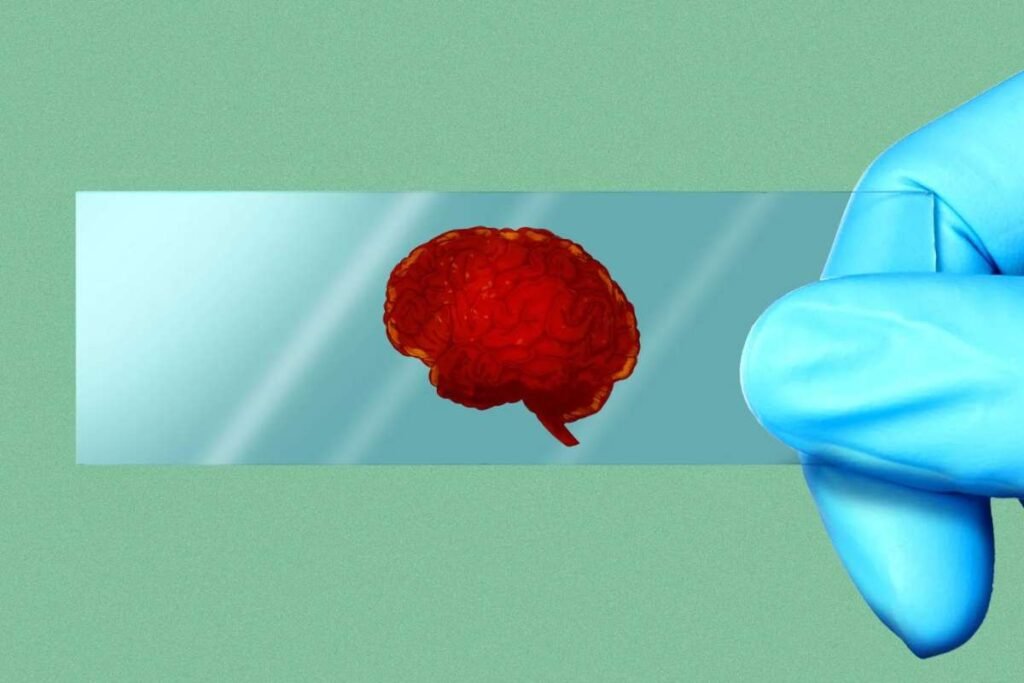 FDA Approves First Blood Test for Alzheimer’s, Paving Way for Earlier Detection