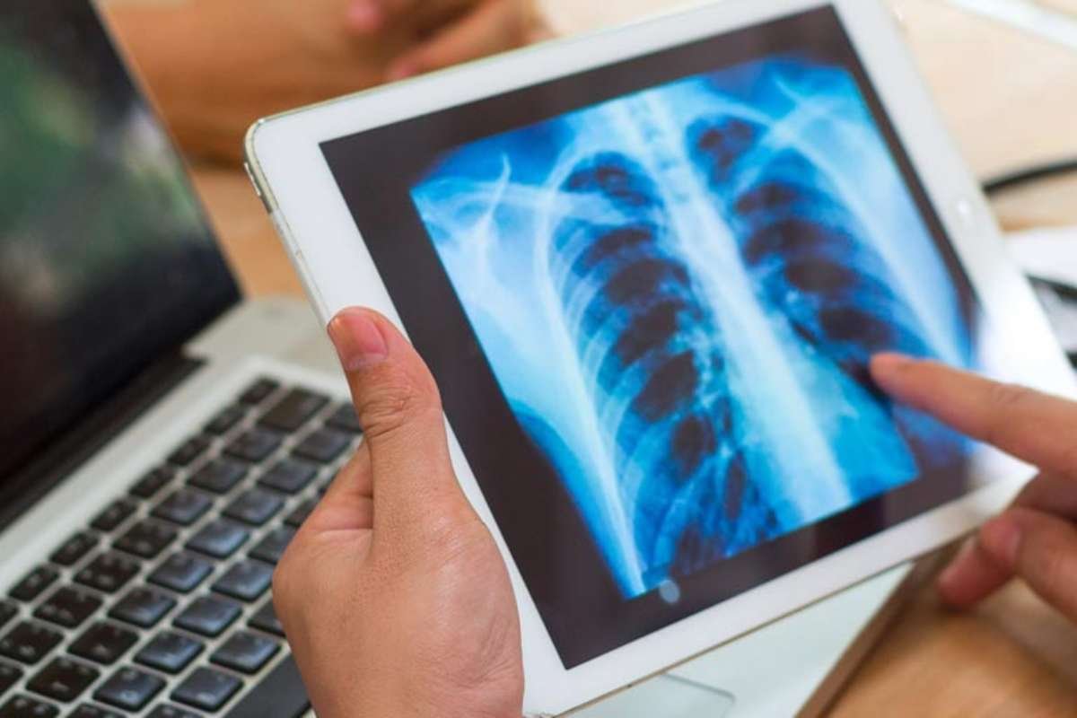 California Emerges as a Top State for Lung Health in National Study