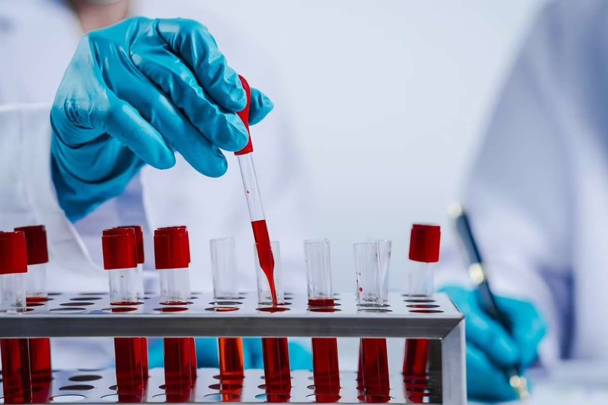 Simple Blood Test May Predict Rapid Cognitive Decline in Early Alzheimer’s Patients