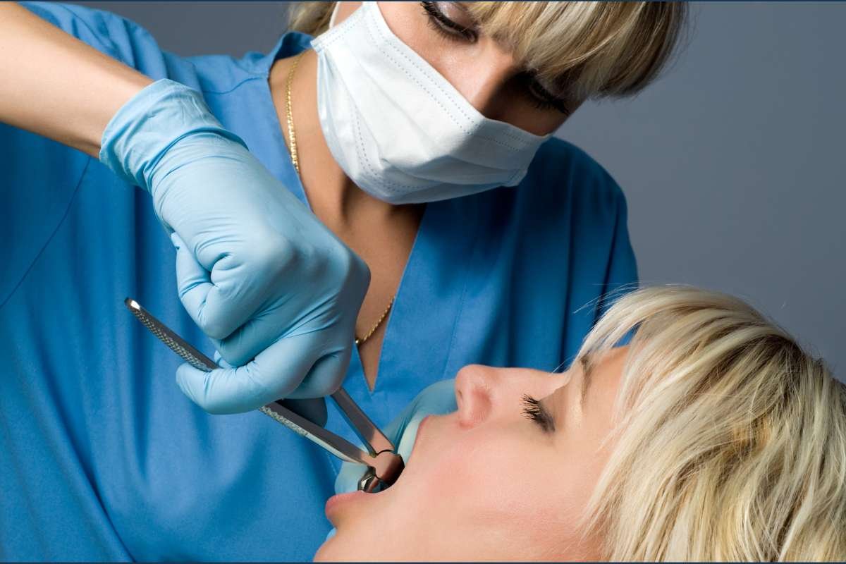 Tooth Extraction: Everything You Need To Know