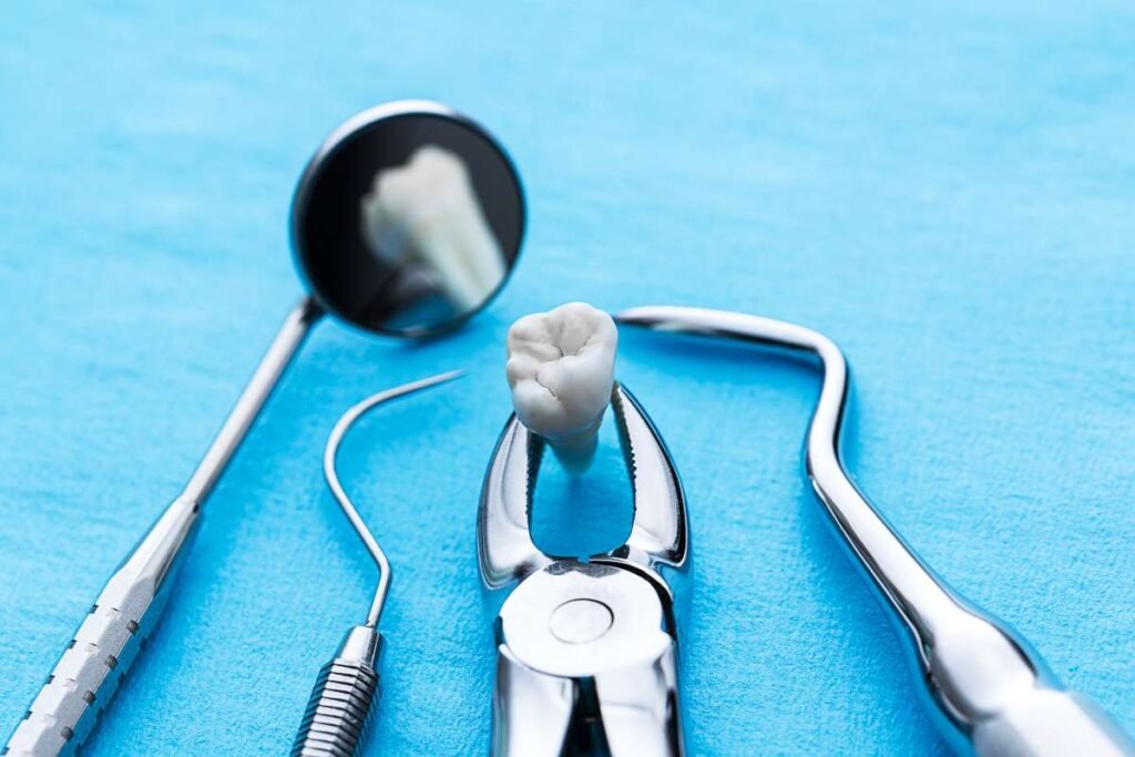 Tooth Extraction: Everything You Need To Know | Healthcare 360 Magazine