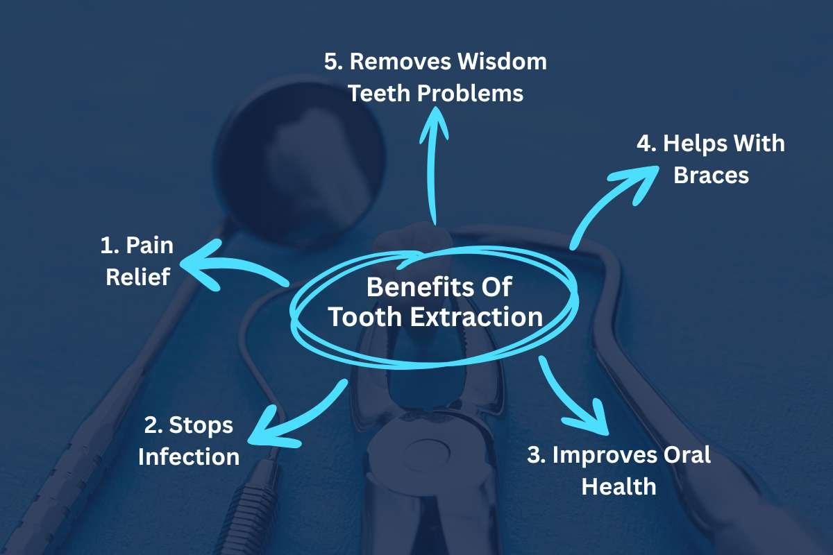Tooth Extraction: Everything You Need To Know | Healthcare 360 Magazine