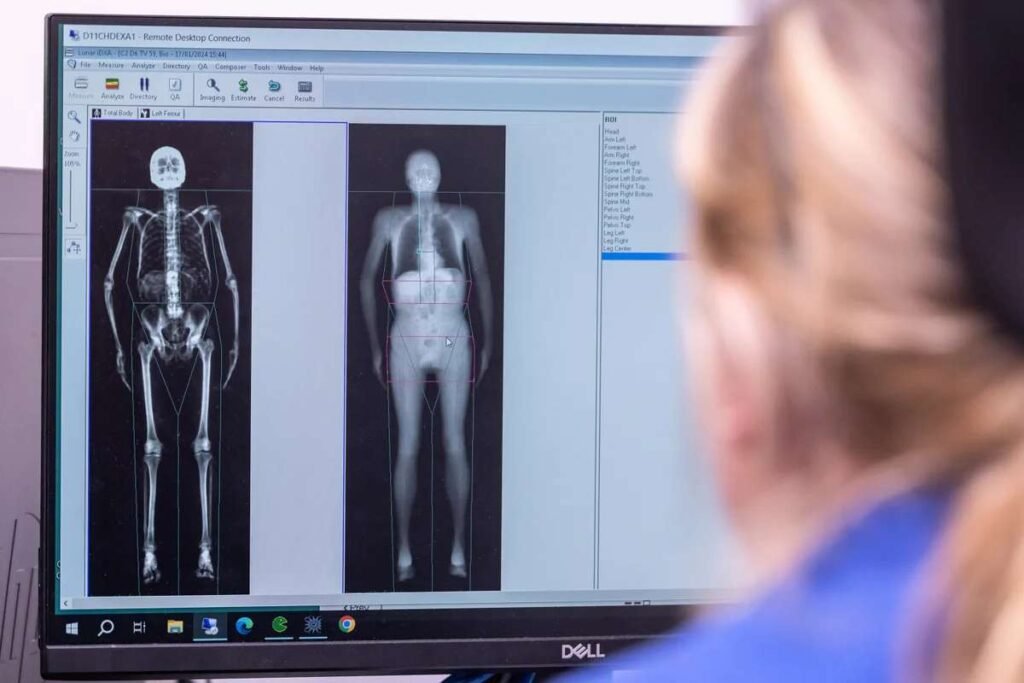 UK Biobank 100,000 Full-Body ScansMethod in Disease Prevention | Healthcare 360 Magazine