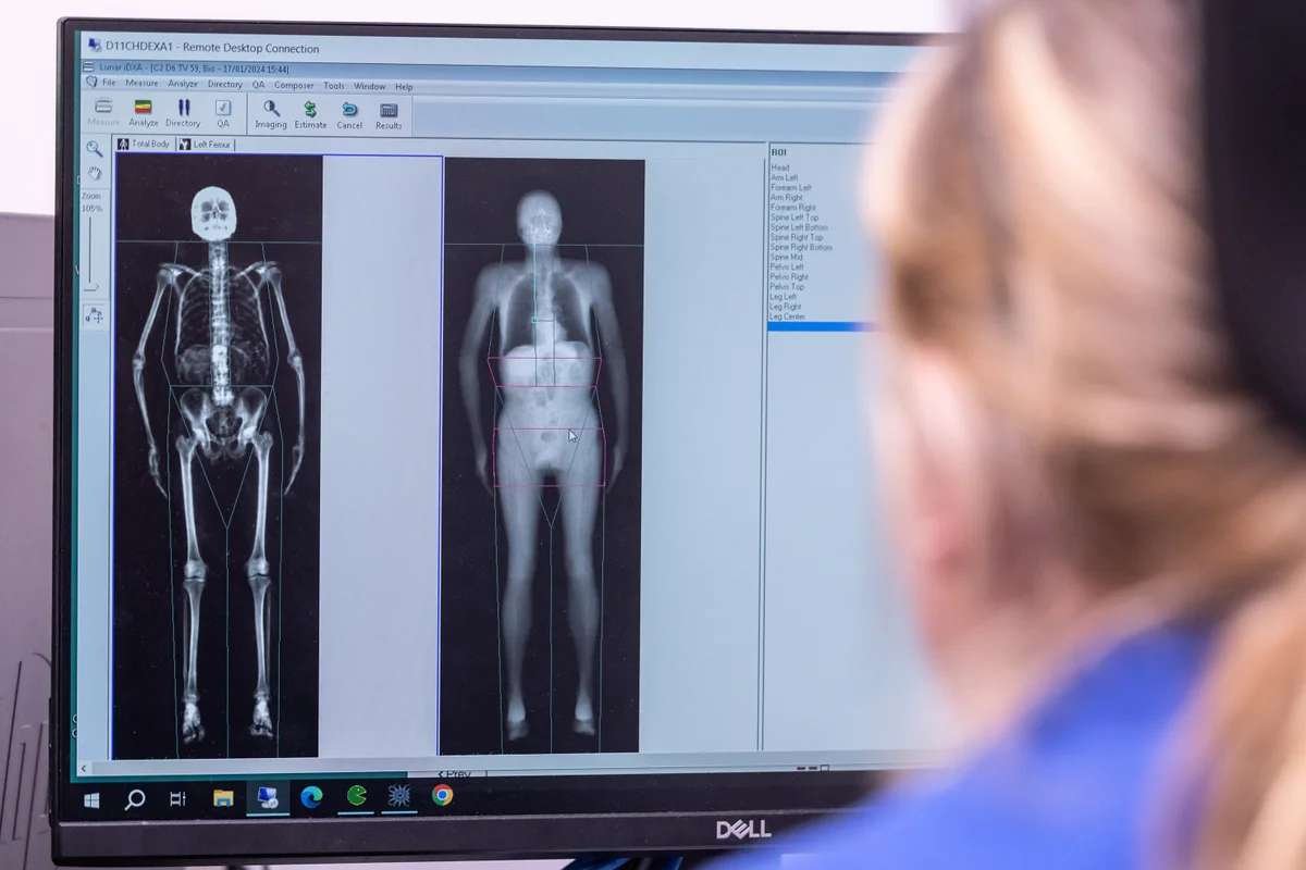 UK Biobank Hits 100,000 Full-Body Scans, Unlocking New Frontiers in Disease Prevention