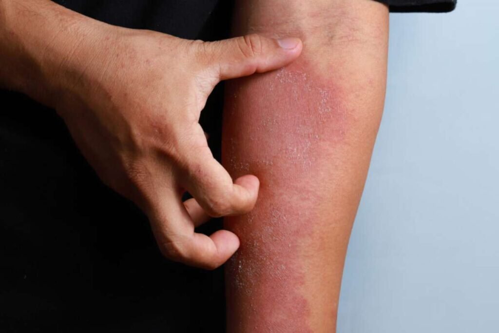 thedermdigest.com