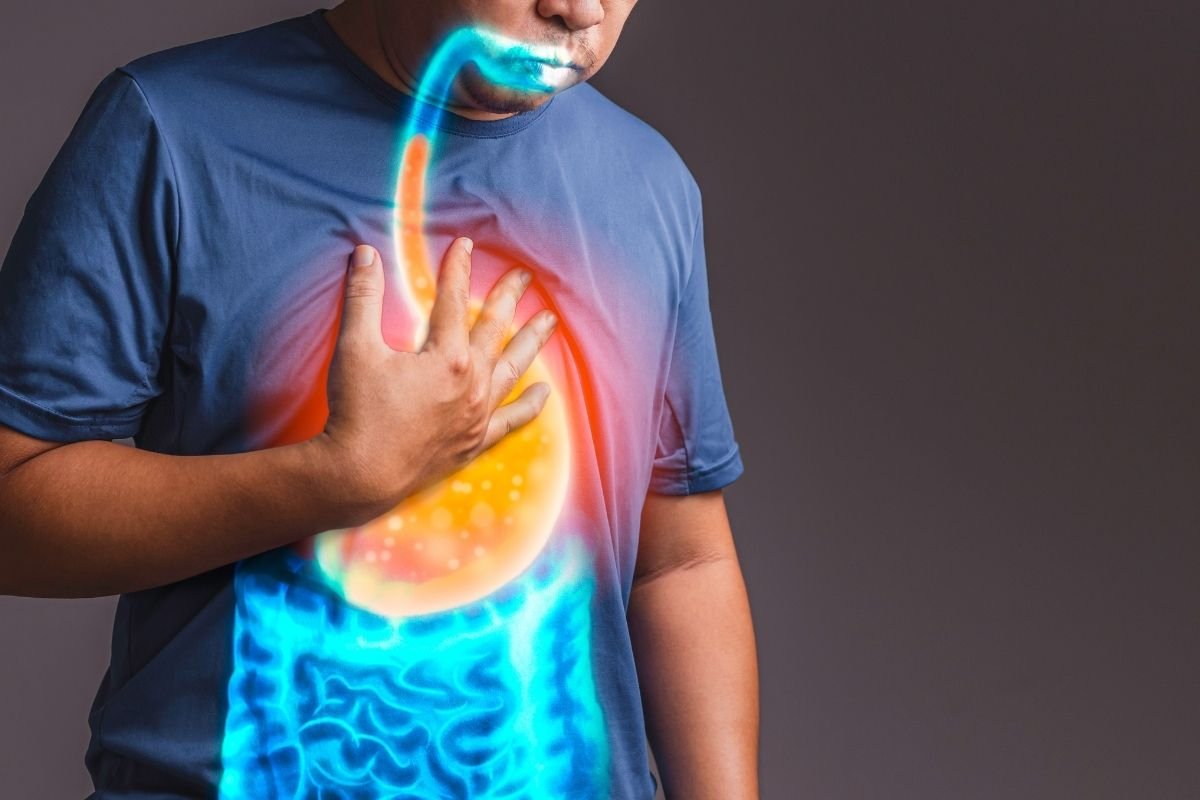 What Are Some Foods To Avoid GERD? Here Is How You Can Reduce Constant Acid Reflux
