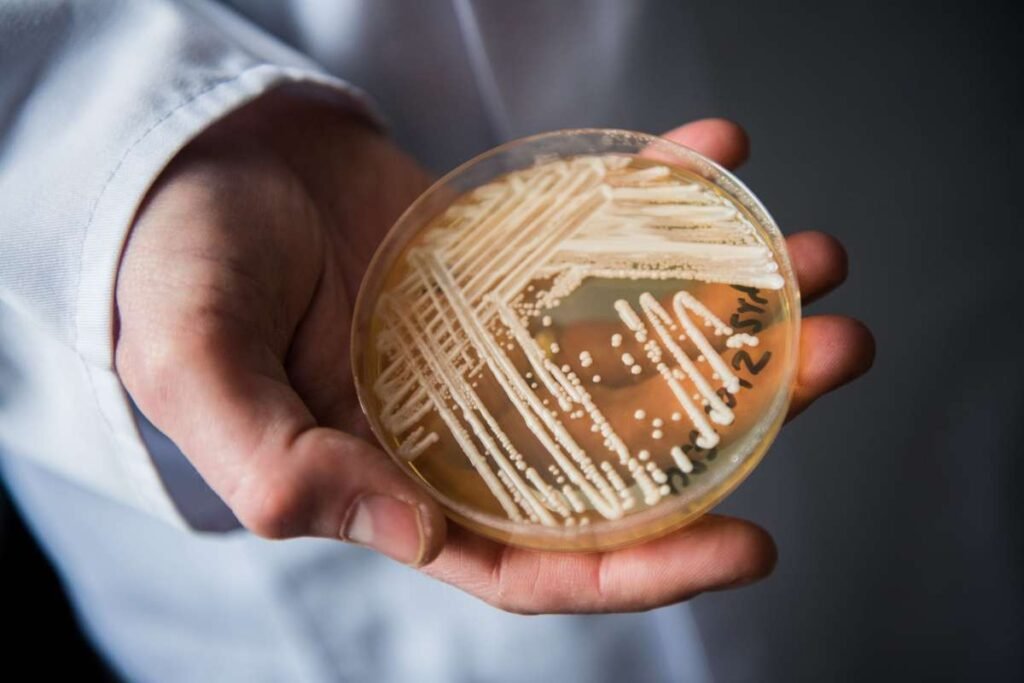 Multidrug-Resistant Candida Auris Cases Europe Raises Concerns | Healthcare 360 Magazine
