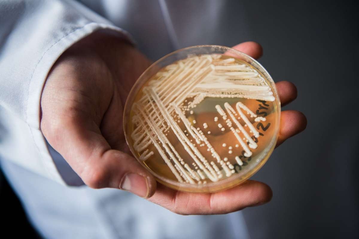 Rapid Rise of Multidrug-Resistant Candida Auris Cases in Europe Raises Alarming Concerns