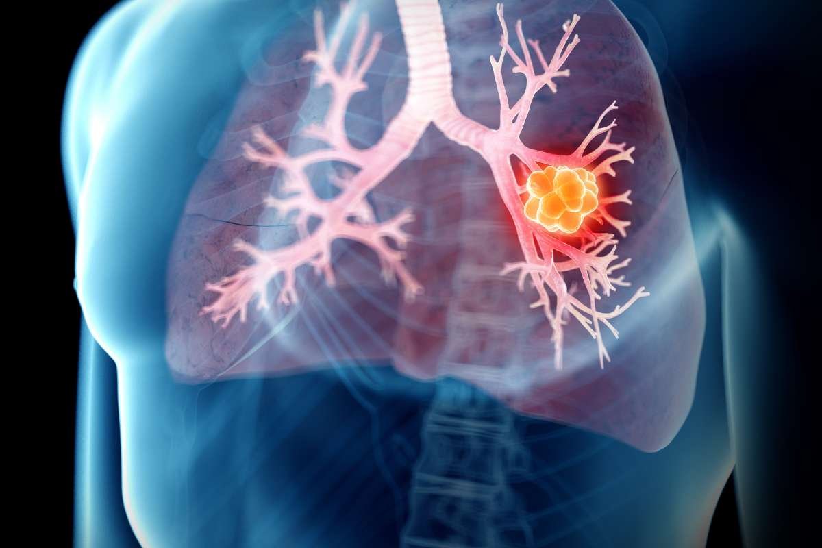 10 Biggest Health Issues for Men You Mustn’t Ignore | Healthcare 360 Magazine