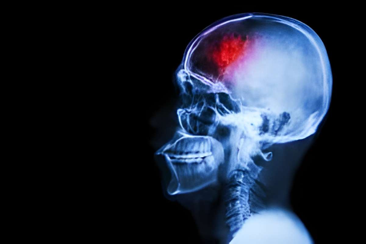 Top 20 Health Benefits of Omega-3 for Your Body | Healthcare 360 Magazine