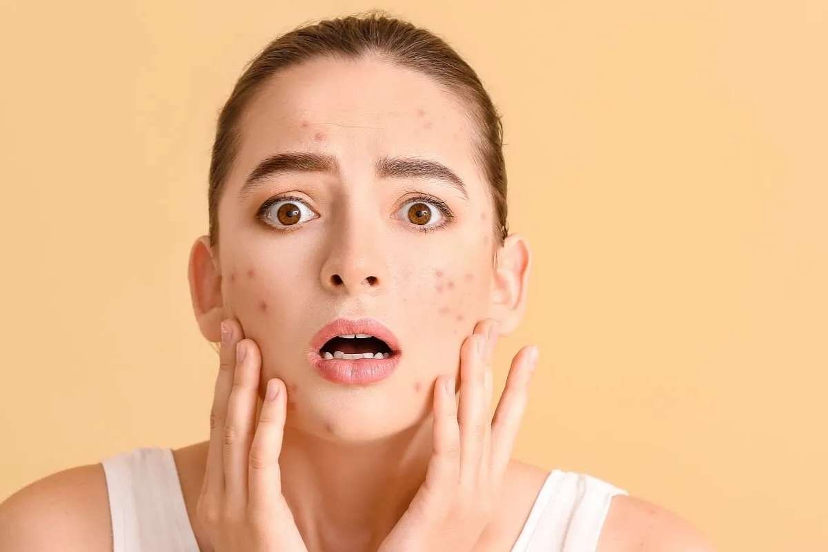 Skin Care Routine for Oily Skin: Beat Grease & Glow | Healthcare 360 Magazine